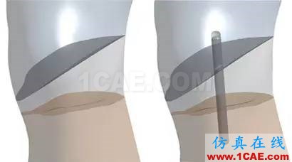 亞當(dāng)沉浮錄--大都會(huì)藝術(shù)博物館的保管員邀請(qǐng)仿真專家?guī)椭迯?fù)具有600年歷史的雕塑 美國(guó)仿真專家首次利用ANSYS協(xié)助修復(fù)破損的雕塑ansys培訓(xùn)課程圖片6